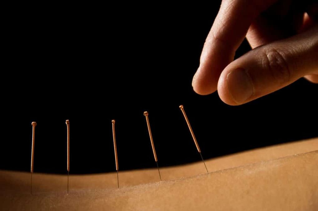 acupuncture for prostatitis