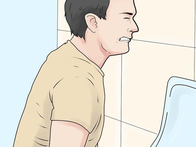 Painful urination is a symptom of exacerbation of prostatitis in men